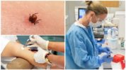 Blodtest för encefalit och borrelios